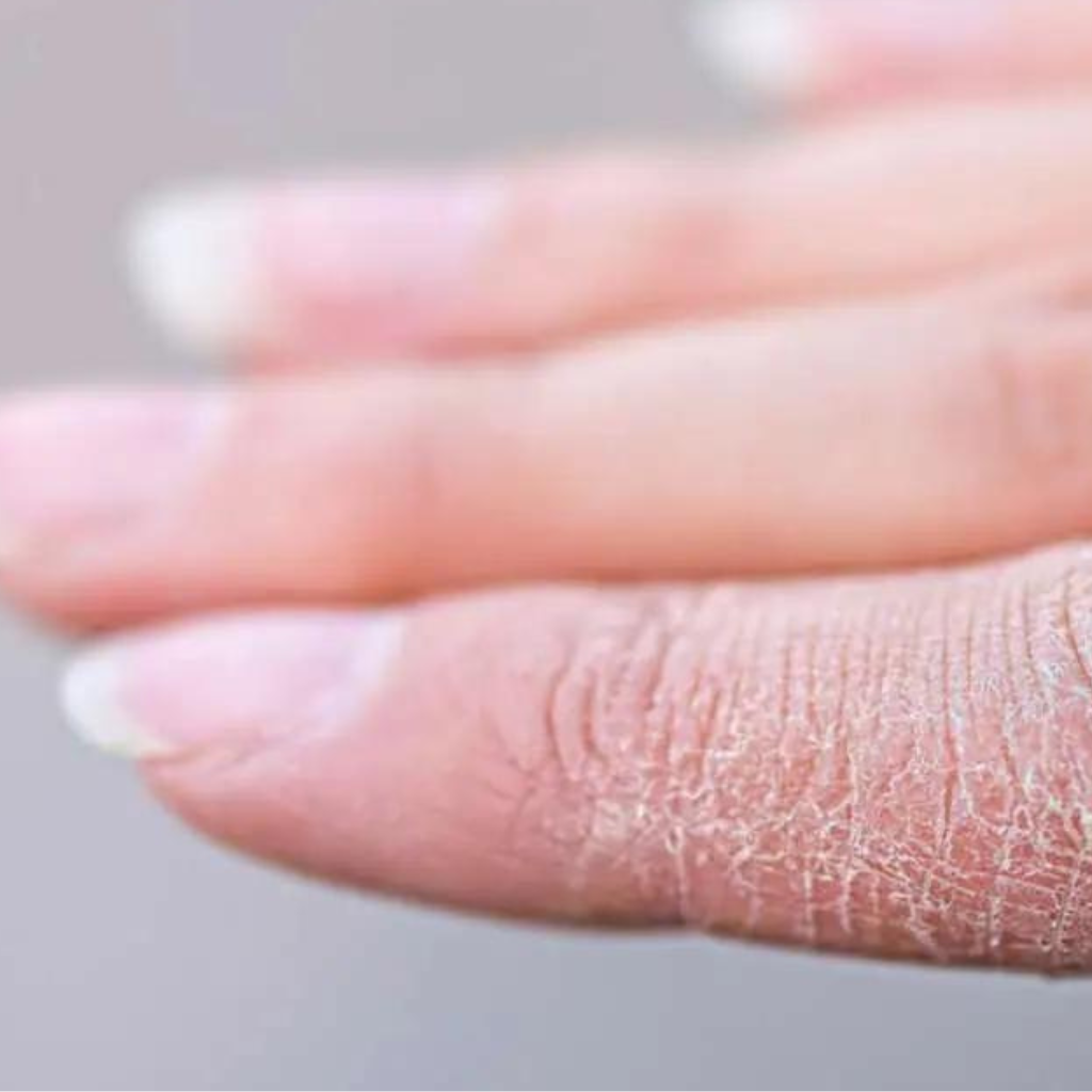 7 Proven Tips to Avoid Dry Winter Skin