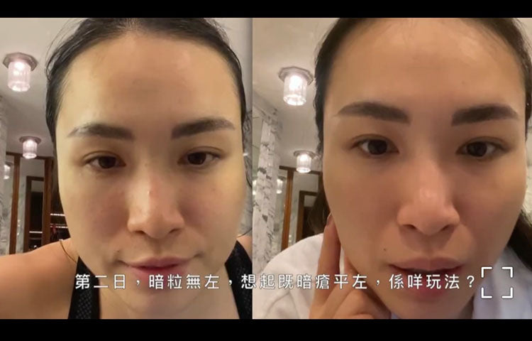 Go-For-Zero-Miod-Blemish-Gel-30ml