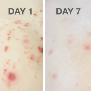 Go-For-Zero-Australia-The-Physic-Garden-Australia-Skin-Rescue-Skin